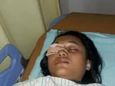 Diduga Akibat Terkena HT oleh Oknum Polisi Saat Operasi Keselamatan 2019, Siswi SMP Terancam Buta Diduga Akibat Terkena HT oleh Oknum Polisi Saat Operasi Keselamatan 2019, Siswi SMP Terancam Buta