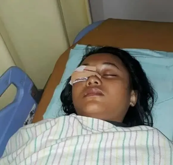 Diduga Akibat Terkena HT oleh Oknum Polisi Saat Operasi Keselamatan 2019, Siswi SMP Terancam Buta Diduga Akibat Terkena HT oleh Oknum Polisi Saat Operasi Keselamatan 2019, Siswi SMP Terancam Buta