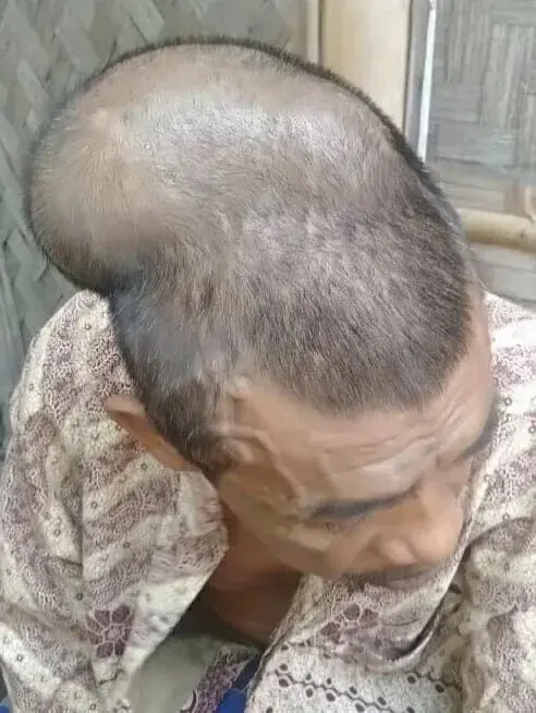 Derita Tumor Ganas, Nelayan Terbaring di Tempat Tidur Selama 3 Tahun Derita Tumor Ganas, Nelayan Terbaring di Tempat Tidur Selama 3 Tahun