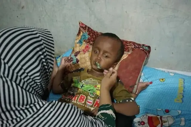 Tidak Ada Biaya, Anak Penderita Hidrosefalus di Purworejo Butuh Uluran Tangan Dermawan