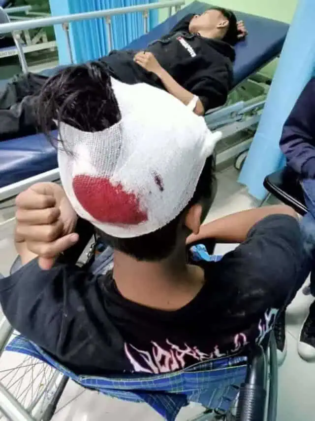 Asep NS : Saya Harap Polisi Serius Tangani LP Penganiayaan/Pembacokan Terhadap Anak Saya Asep NS : Saya Harap Polisi Serius Tangani LP Penganiayaan/Pembacokan Terhadap Anak Saya