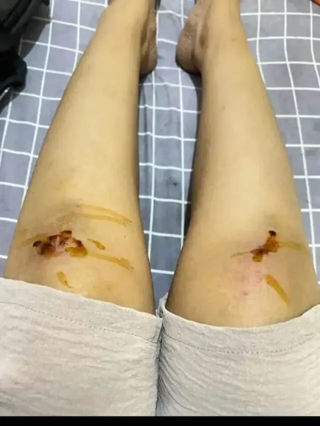 Petaka Warga Asal Pengarengan Hendak Berangkat Kerja Malah Jadi Korban Begal