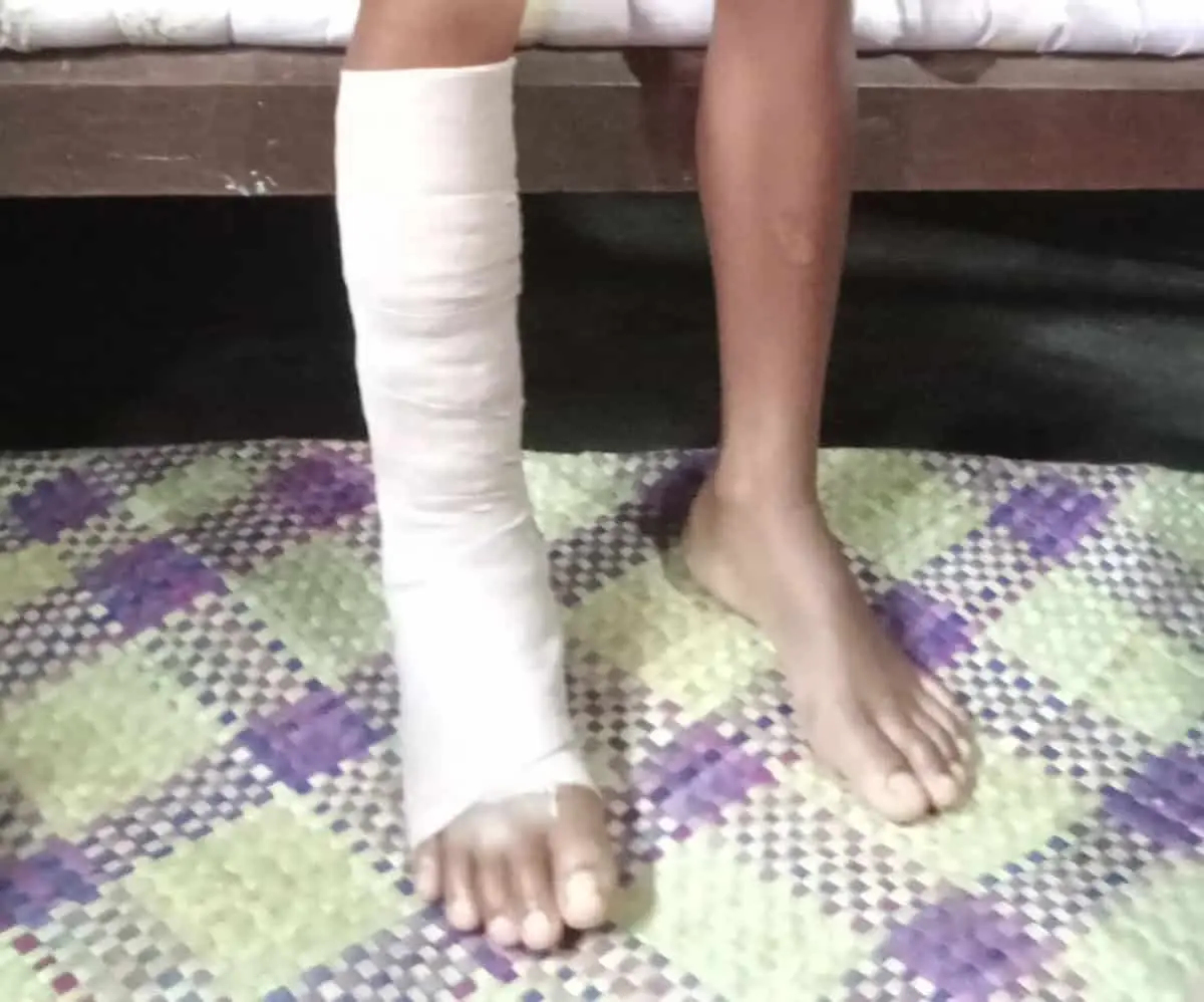 Seorang Ayah Di Manggarai Laporkan Dugaan Kekerasan Yang Menyebabkan Anaknya Patah Kaki Ke Polres Manggarai NTT Seorang Ayah Di Manggarai Laporkan Dugaan Kekerasan Yang Menyebabkan Anaknya Patah Kaki Ke Polres Manggarai NTT